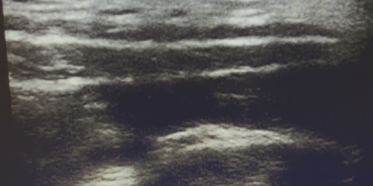 Cefaleas y Migrañas — Clínica San Giovanni, Asunción