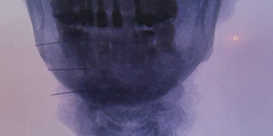 Dolor Craneofacial — Clínica San Giovanni, Asunción