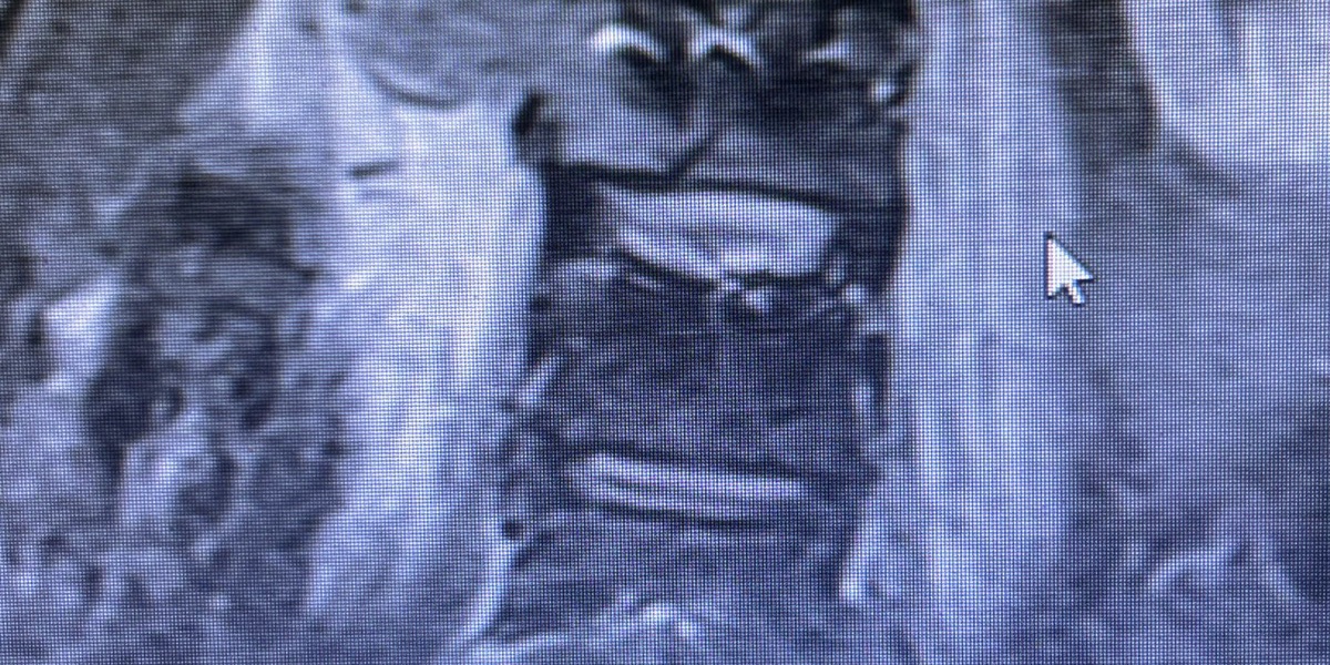 Dolor Oncológico — Clínica San Giovanni, Asunción